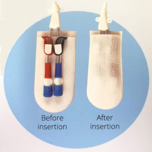 CathGuard-Catheter_1000x1000