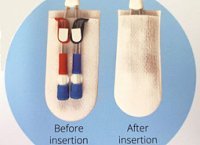 CathGuard-Catheter_Insertion_2_website-200x145